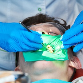 A dentist performing pulp therapy on a male patient
